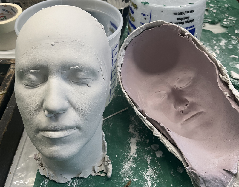 calco anatomico